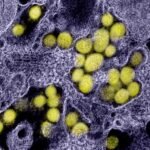 Disease detectives track an invisible virus